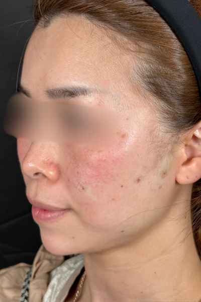 Postoperative Condition Part 1