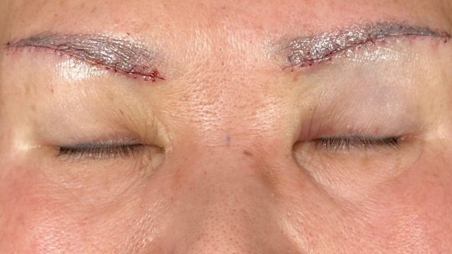 Postoperative Condition Part 1