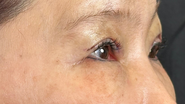 手术前的状态 其一