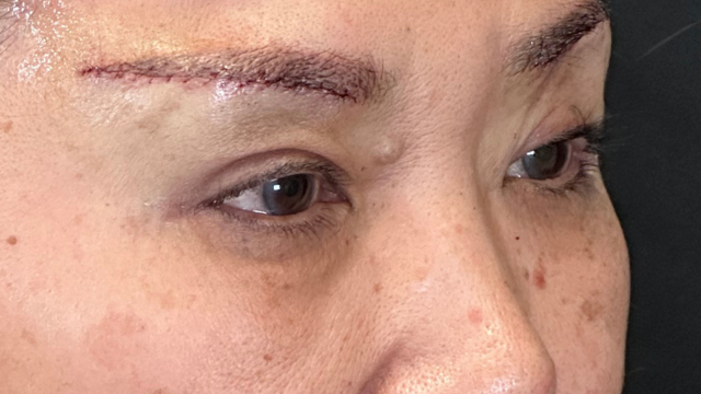 Postoperative Condition Part 1