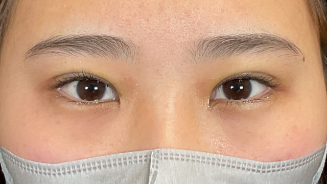 手术前的状态 其一