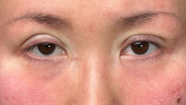 Postoperative Condition Part 1