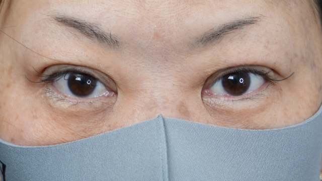 手术前的状态 其一