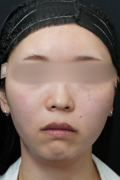 Postoperative Condition Part 1