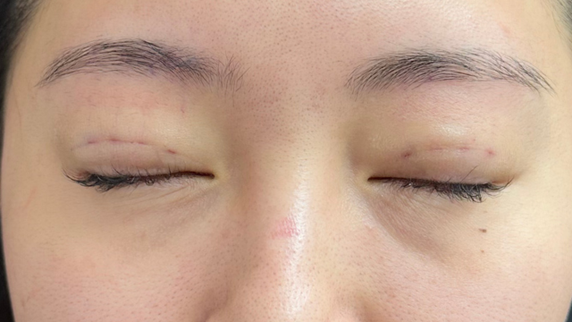 手术前的状态 其一