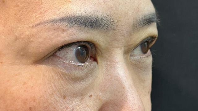 Postoperative Condition Part 1