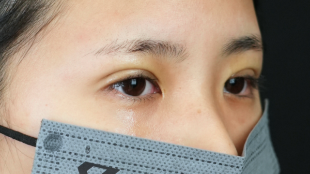 手术前的状态 其一