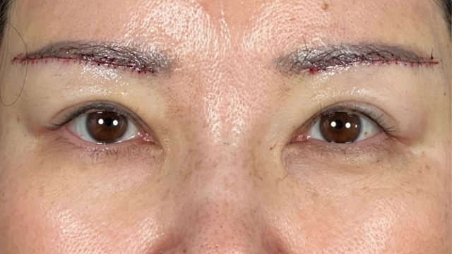 Postoperative Condition Part 1