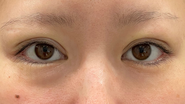 Postoperative Condition Part 1