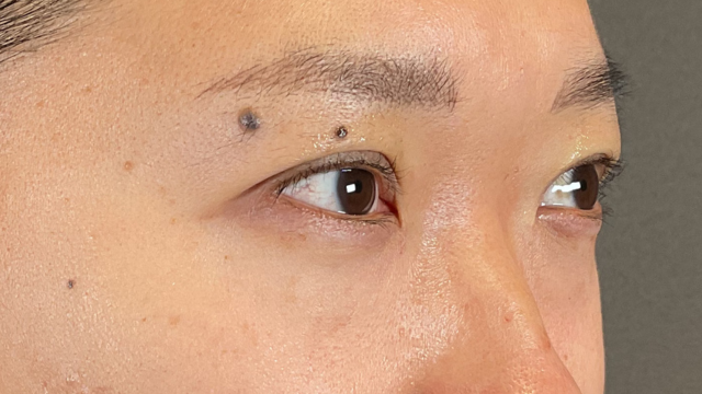 Postoperative Condition Part 1