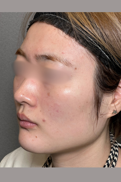 手術前の状態 その1