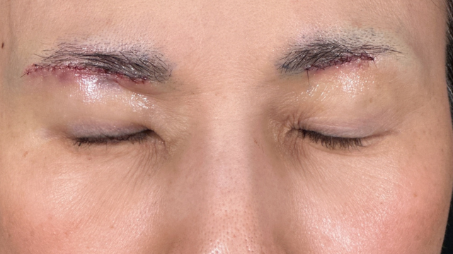 手術前の状態 その1