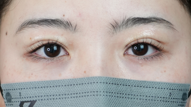 Postoperative Condition Part 1