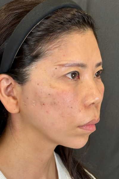 手术前的状态 其一