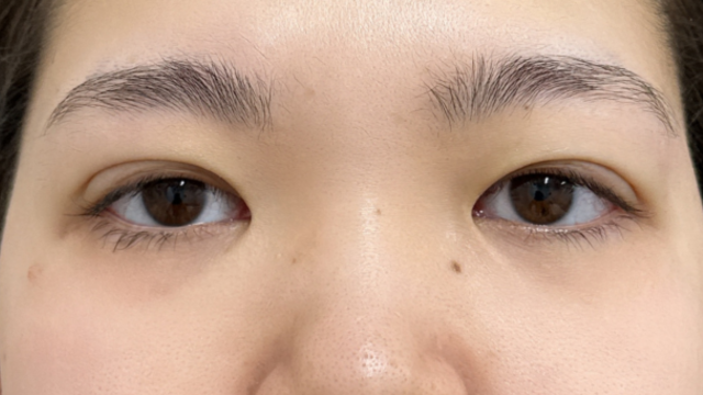 手术前的状态 其一