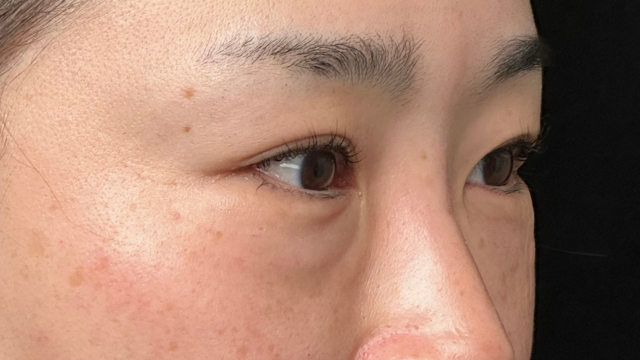 手术前的状态 其一