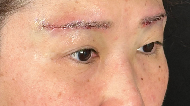 手术前的状态 其一