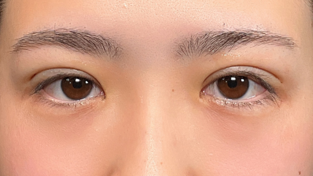 手术前的状态 其一