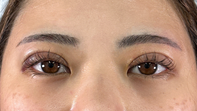 Postoperative Condition Part 1