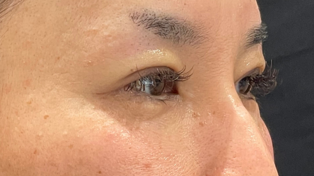 手术前的状态 其一