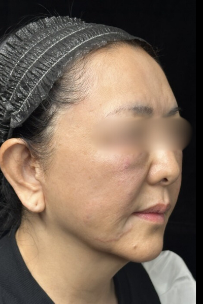 手術前の状態 その1