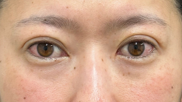 手术前的状态 其一