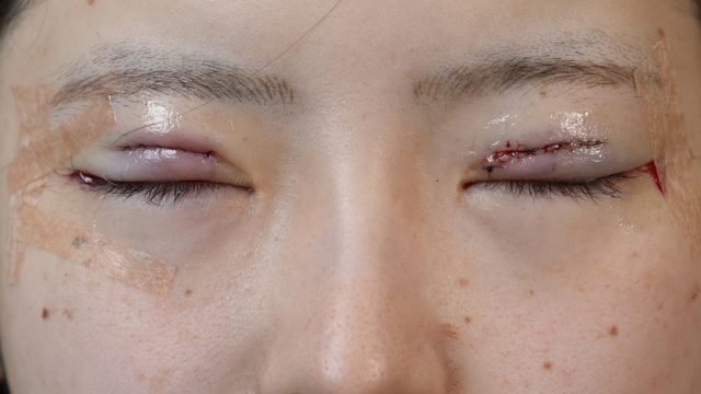 手術前の状態 その1