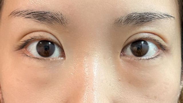 手术前的状态 其一