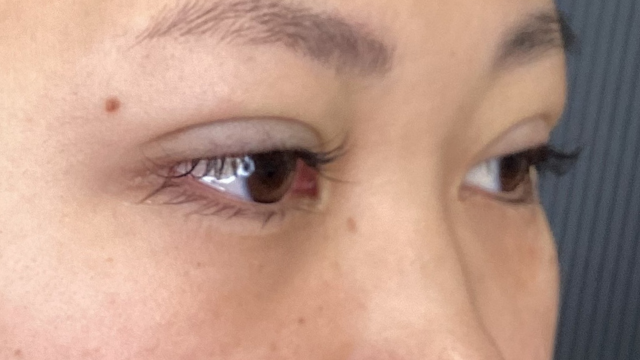 Postoperative Condition Part 1