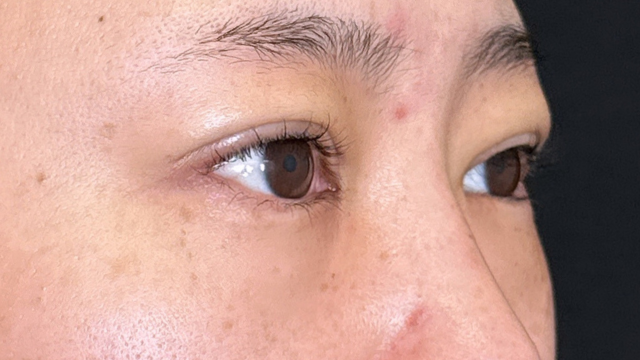 手术前的状态 其一