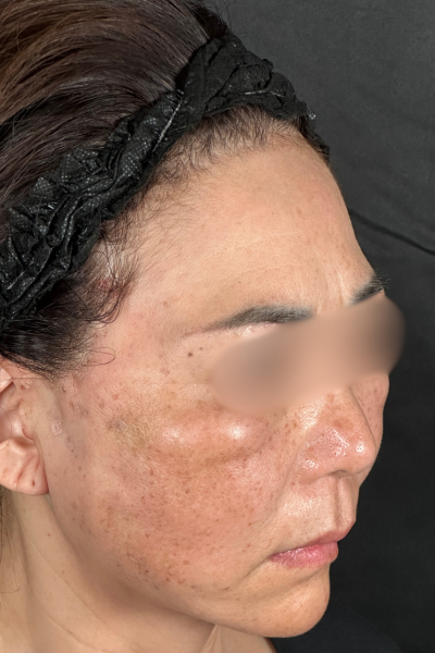 手術前の状態 その1