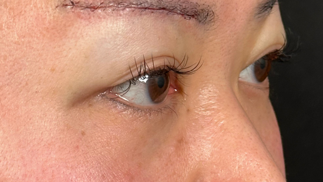 Postoperative Condition Part 1