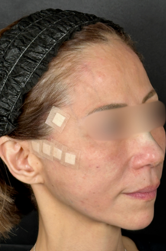 手術前の状態 その1