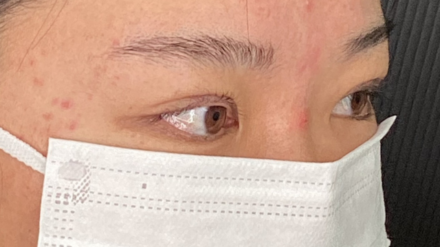 手術前の状態 その1