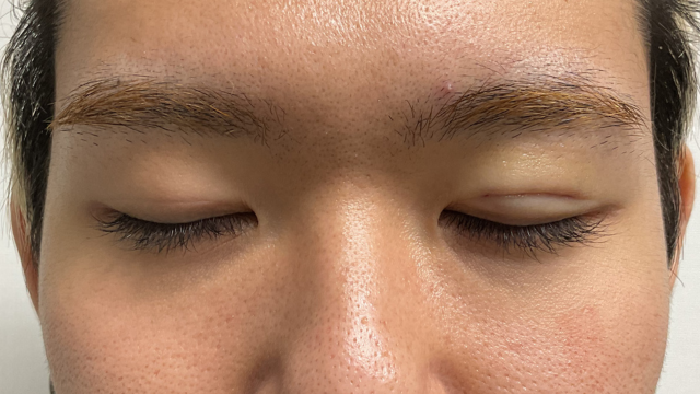 Postoperative Condition Part 1