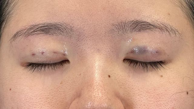 手术前的状态 其一