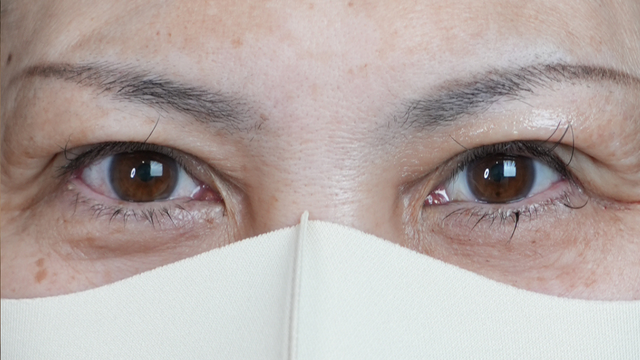 手术前的状态 其一