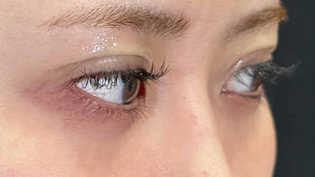 手术前的状态 其一