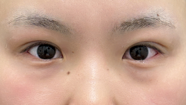 Postoperative Condition Part 1