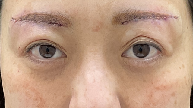 Postoperative Condition Part 1