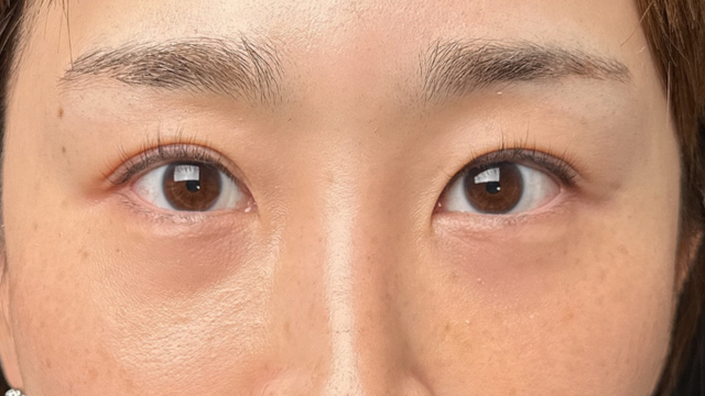 手术前的状态 其一