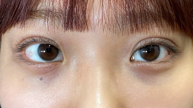 Postoperative Condition Part 1