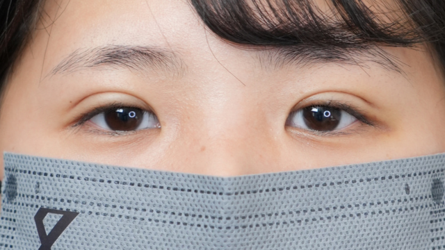 手术前的状态 其一