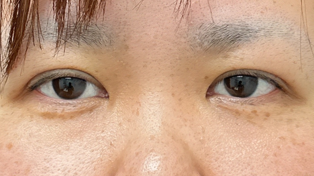 Postoperative Condition Part 1