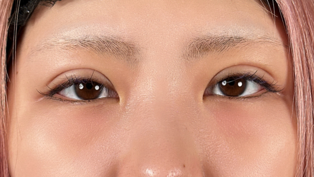 手术前的状态 其一