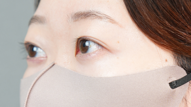 手術前の状態 その1