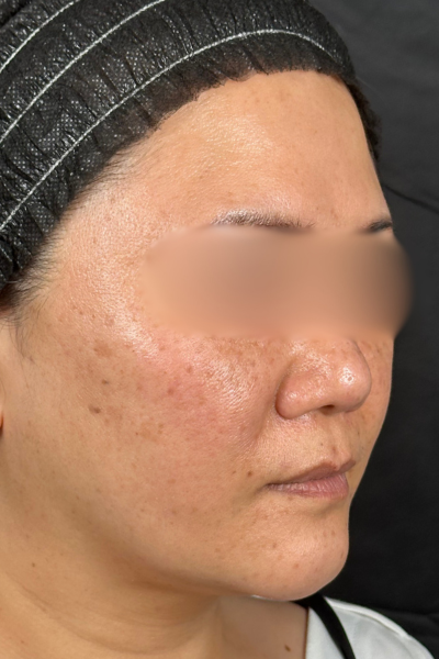 手術前の状態 その1