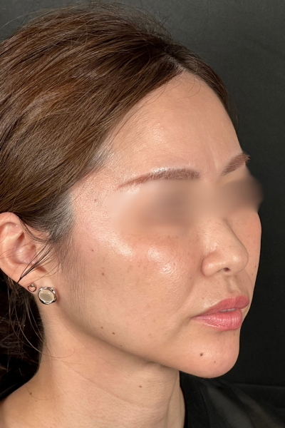 手术前的状态 其一