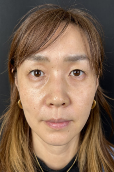 手術前の状態 その1