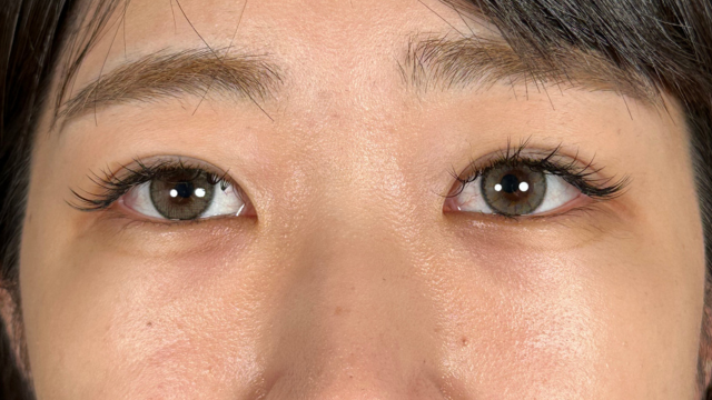 手术前的状态 其一